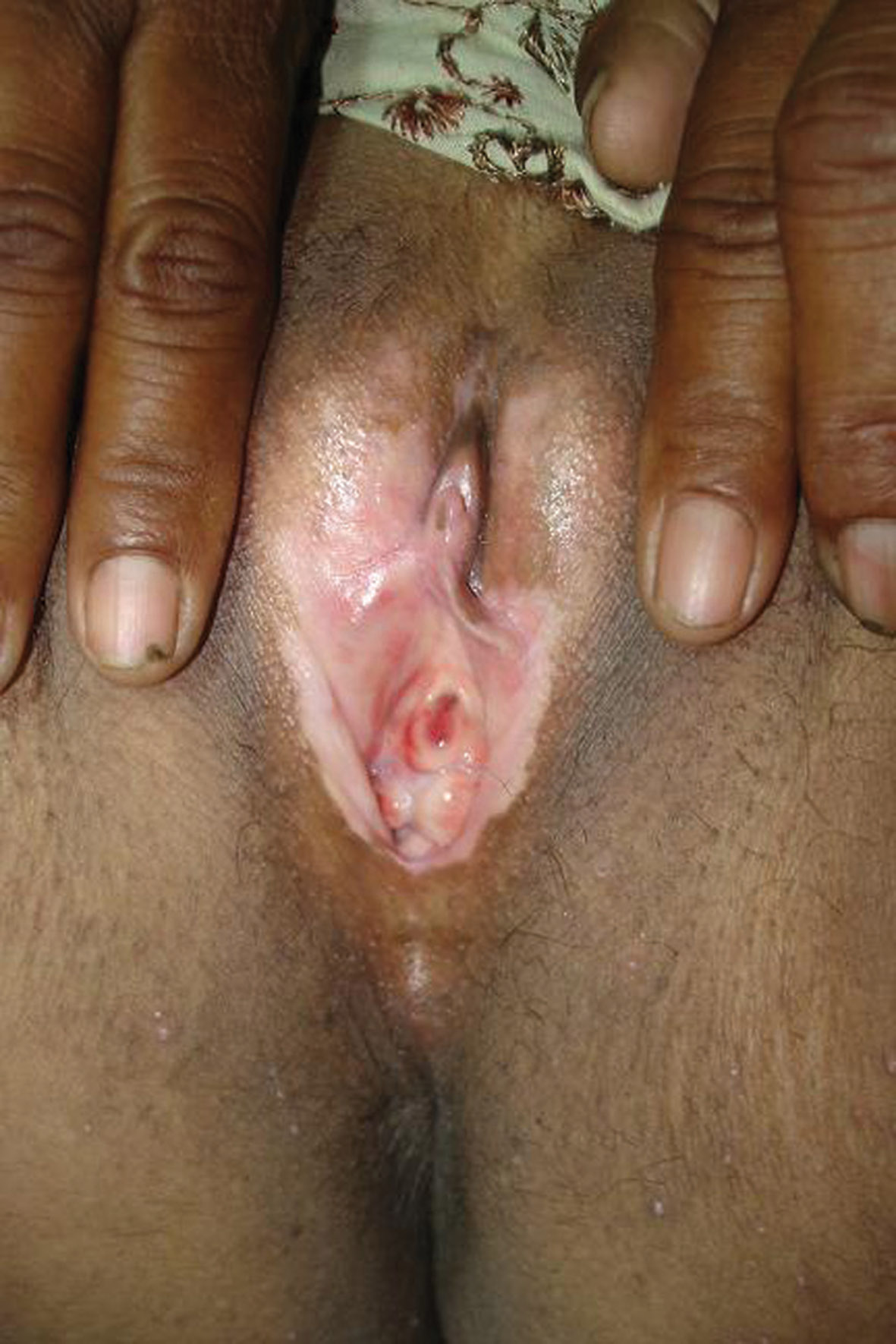 Black south african teen hairy pussy